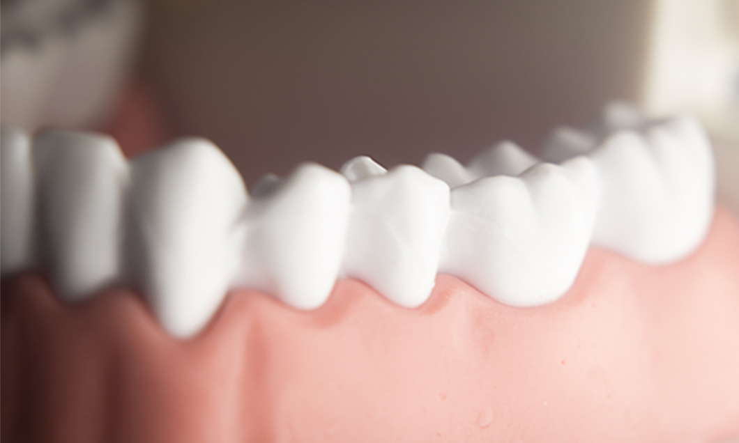 歯周外科治療・歯周組織再生療法